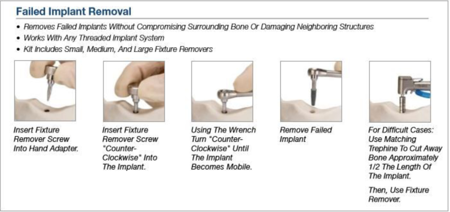 Implant Removal Instructions